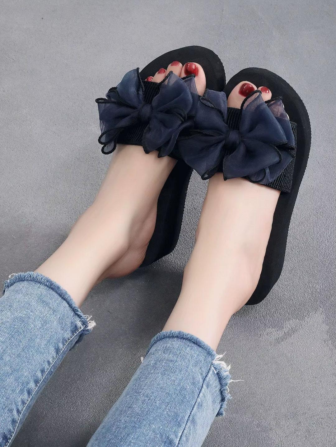 Mireia® - Orthopaedic Sandals | Premium Edition